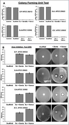 Preliminary osteogenic and antibacterial investigations of wood derived antibiotic-loaded bone substitute for the treatment of infected bone defects